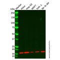 Recombinant TOMM20 Antibody