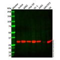 Recombinant TPMT Antibody