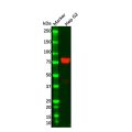 Transferrin Mouse mAb