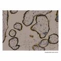Recombinant Transferrin Receptor Antibody