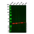 Recombinant TREX1 Antibody