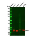 UBE2C Antibody