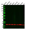 Recombinant UBE2I Antibody