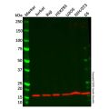 Recombinant Ube2N/Ubc13 Antibody