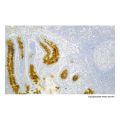 Recombinant VEGF Receptor 2 Antibody