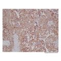 Recombinant VEGFA Antibody