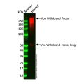 Recombinant Von Willebrand Factor Antibody