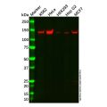 VPRBP Antibody