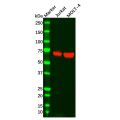 Recombinant ZAP70 Antibody