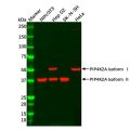 PIP4K2A Antibody