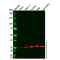 Bcl-2 Mouse mAb