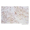 Recombinant BCA-225 Antibody