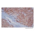 Recombinant CAM5.2 Antibody