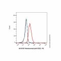 Moxetumomab (anti-CD22)