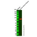Transferrin Mouse mAb