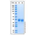 Recombinant Human Azurocidin/CAP37/HBP Protein