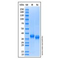 Recombinant Human Cathepsin X/Z/P Protein