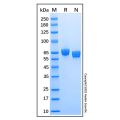 Recombinant Human EphA7 Protein