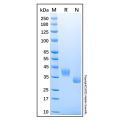 Recombinant Human Prostasin/Prss8 Protein