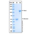 Recombinant Human SECTM1 Protein
