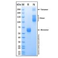 Recombinant Mouse TGF-beta RII Protein