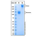 Recombinant Mouse IL-31RA Protein