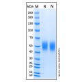Recombinant Human IL-17RD/SEF Protein