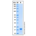 Recombinant Human CD20 Protein