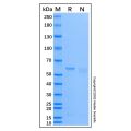 Recombinant Human SQSTM1/p62 Protein