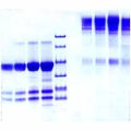 免疫球蛋白 M,Fc5μ片段 来源于人血浆