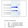 免疫球蛋白G1 (IgG1) 来源于人血浆