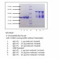 免疫球蛋白G1 (IgG1), FC片段 来源于人骨髓瘤血浆
