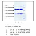 免疫球蛋白G1 (IgG1) 来源于人骨髓瘤血浆