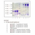 免疫球蛋白G (IgG), F (ab')₂片段 来源于人血浆