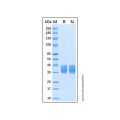Recombinant Human CD157 Protein