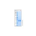 Recombinant Human Carbonic Anhydrase XII Protein