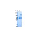 Recombinant Human SR-AI/MSR Protein