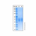 Recombinant Human Fc epsilon RI alpha Protein