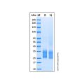 Recombinant Human HAI-2A Protein