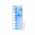 Recombinant Human IFN-alpha/beta R2 Protein