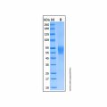 Recombinant Human IL-1Rrp2/IL-1R6 Protein