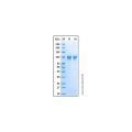 Recombinant Human Neuroligin 3/NLGN3 Protein