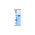 Recombinant Human Neuroligin 4/NLGN4 Protein