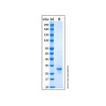 Recombinant Human Lamin B1 Protein