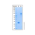 Recombinant Human Noggin Protein