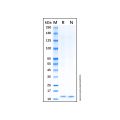 Recombinant Human Osteocalcin Protein