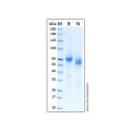 Recombinant Human AFP Protein
