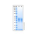 Recombinant Human Fc gamma RIIIA/CD16a Protein