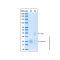 Recombinant Human IL-17E Protein