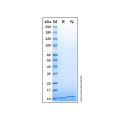 Recombinant Human CCL17/TARC Protein